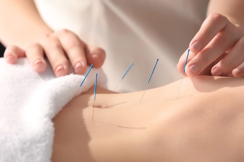 Experience Expert Acupuncture In Richmond Hill With A TCM Registered Acupuncturist At Toronto Wellness & Physio Centre. Safe, Professional, Affordable Care.
